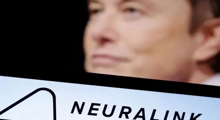 Ya tiene Neuralink permiso de la FDAt